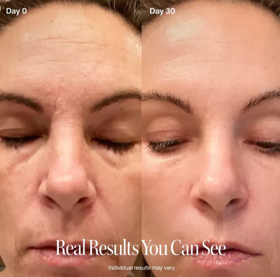 Velora™ Sculpt Contour Pro
