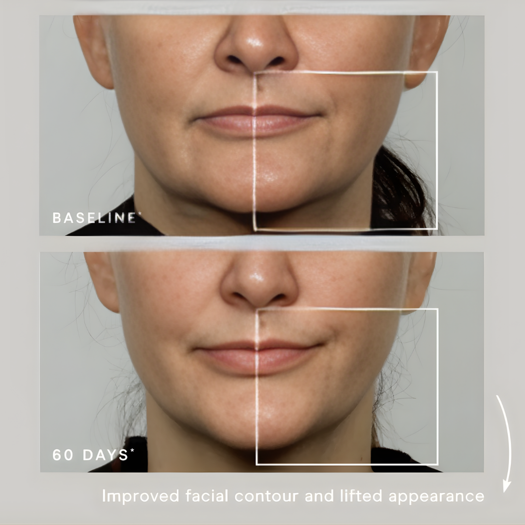 Electra™ Microcurrent Facial Toning Device