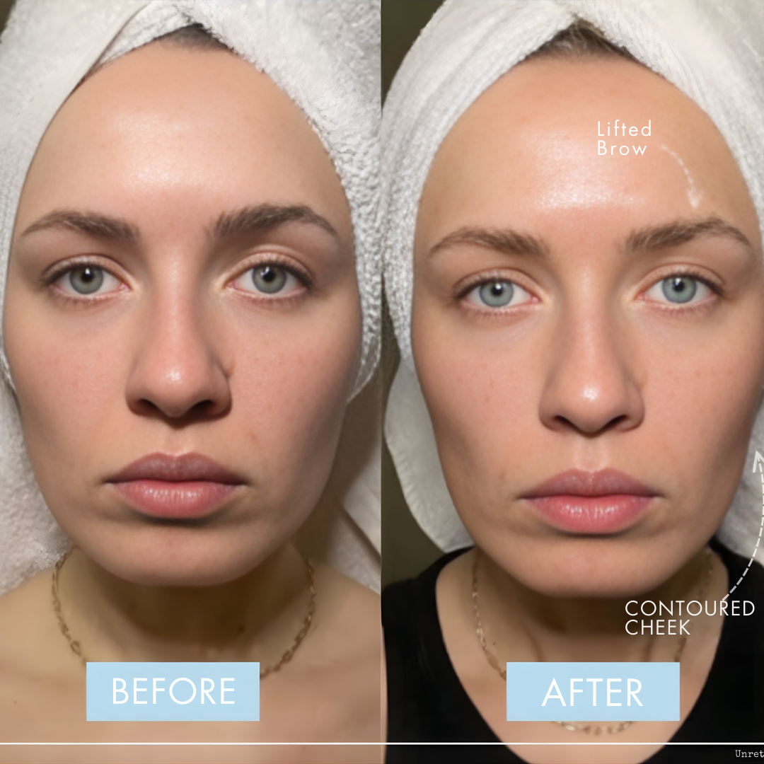 Electra™ Microcurrent Facial Toning Device