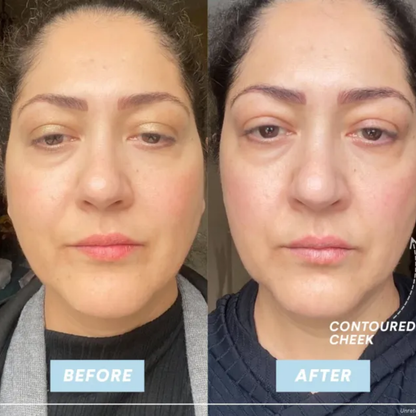 Electra™ Microcurrent Facial Toning Device