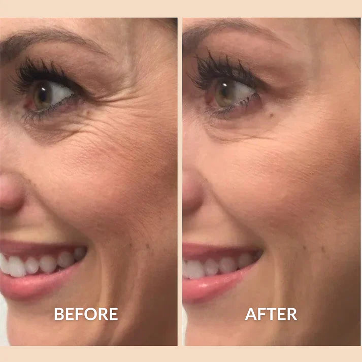 Eterna™ Silicone Healing Strips