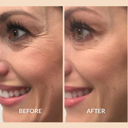 Eterna™ Silicone Healing Strips