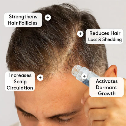 Lexinovo™ Hair Infusion System