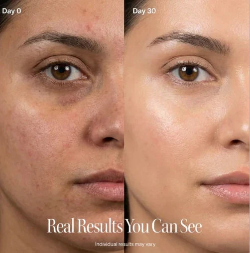 Velora™ Sculpt Contour Pro