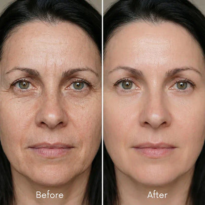 DermaSilk™ Collagen Ampoules