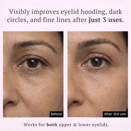 Auréline™ PDRN & Collagen Eye Patches