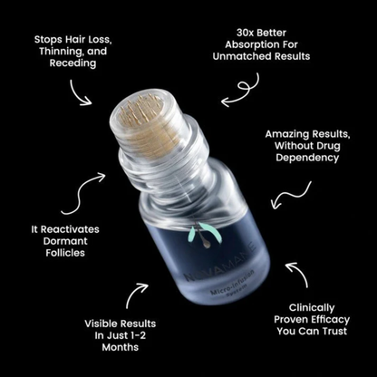 Lexinovo™ Hair Infusion System
